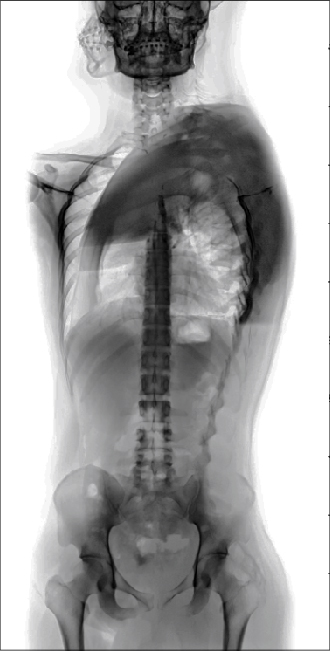imagen de actividad Presentación del libro Radiografías. Ensayos autobiográficos desde los márgenes