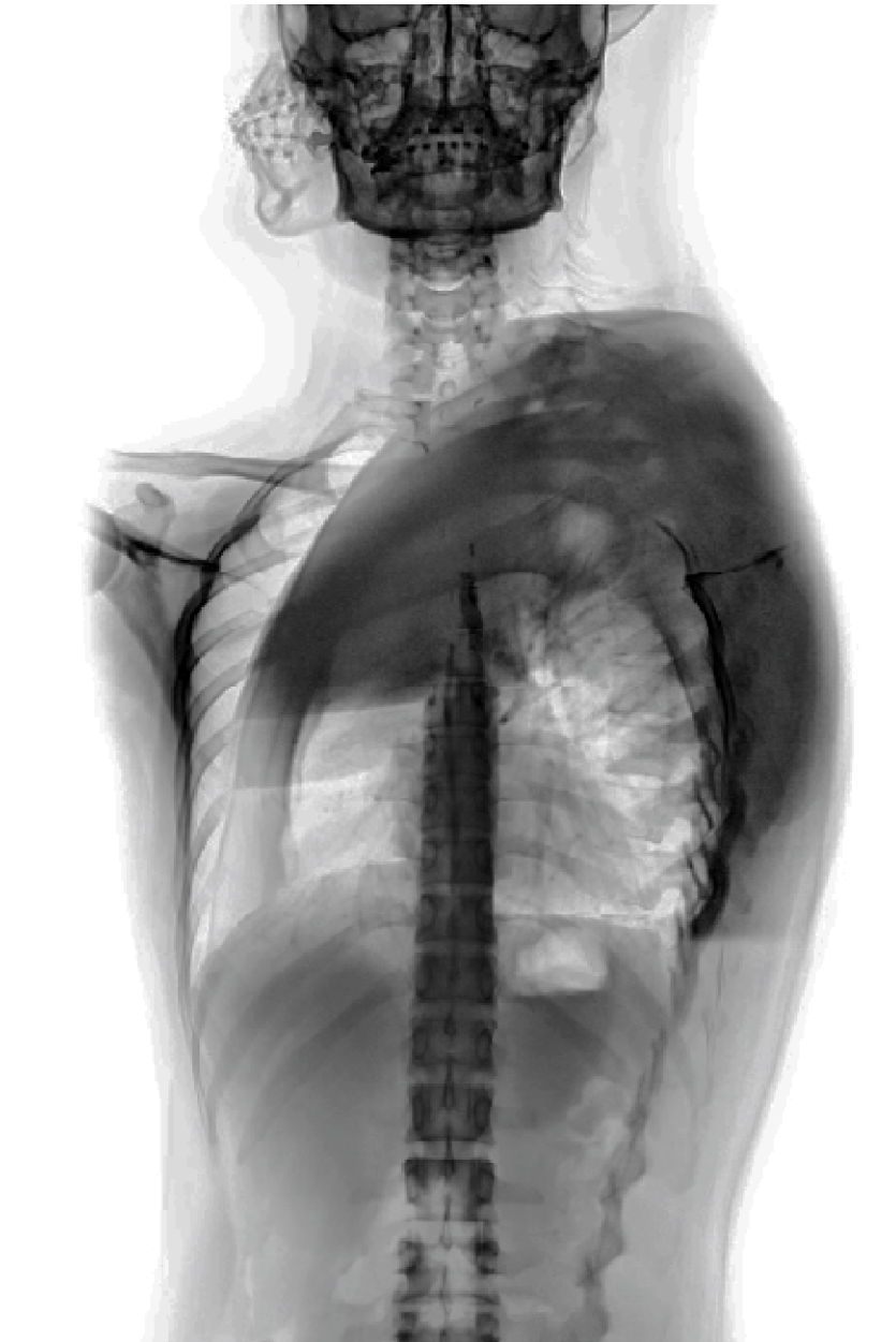 imagen de presentación Radiografías